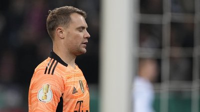 "Дуже особиста історія". Мануель Ноєр тричі переніс операцію через рак шкіри: що про це відомо