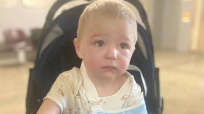 Львівські хірурги прооперували 2-річного хлопчика з вродженою патологією рук