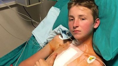 "Почав цінувати життя": 13-річний волинянин із пересадженим серцем готується до виписки з лікарні "Почав цінувати життя": 13-річний волинянин із пересадженим серцем готується до виписки з лікарні