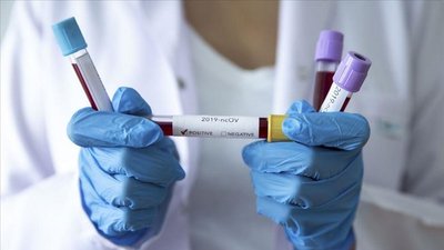256 випадків захворювання на коронавірус виявили за добу на Полтавщині