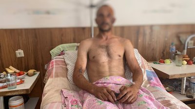 "Кулі літали, аж щебінь злітав" — чоловік, якого при спробі евакуації з окупованої Херсонщини обстріляли війська РФ