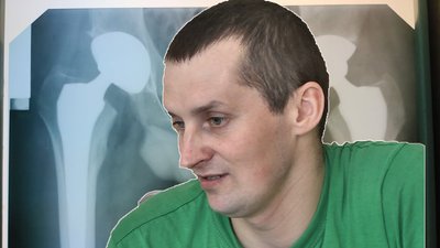 Гроші зібрали небайдужі: АТОвцю з Волині замінили тазостегнові суглоби на штучні