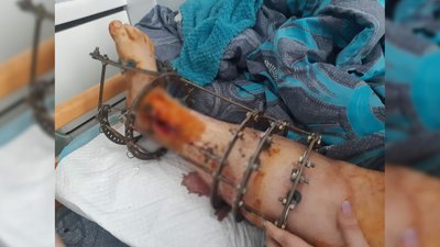 Після втрати сина ультрамарафонець Максим Ус намагається поставити на ноги дружину Після втрати сина ультрамарафонець Максим Ус намагається поставити на ноги дружину