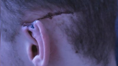 "Вижив після пострілу в голову". Нацгвардієць продовжує служити у Хмельницькому "Вижив після пострілу в голову". Нацгвардієць продовжує служити у Хмельницькому