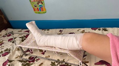 У справі травмованої через падіння світлофора в Полтаві проведуть дві експертизи У справі травмованої через падіння світлофора в Полтаві проведуть дві експертизи