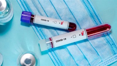 44 випадки інфікування COVID-19 зафіксували в Закарпатській області
