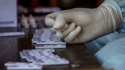 104 випадки захворювання на коронавірус виявили за добу на Полтавщині