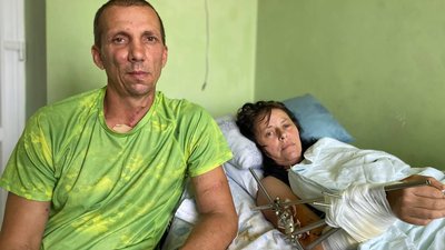 Пересадили м'язи зі спини. Львівські хірурги врятували бахмутянці ногу від ампутації
