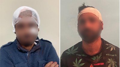 Двох людей затримали, чотирьох — госпіталізували внаслідок сварки між двома родинами на Закарпатті