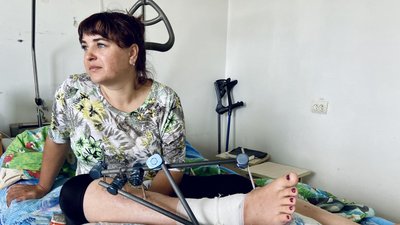 Ракети влучали в дім чотири рази. Історія 34-річної жінки з Авдіївки, яка отримала важке поранення