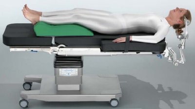 У ЦМЛ Рівного куплять операційний нейрохірургічний стіл. Для чого він потрібний У ЦМЛ Рівного куплять операційний нейрохірургічний стіл. Для чого він потрібний