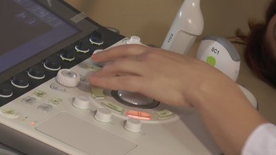 У Франківських поліклініках встановили три нові УЗД апарати У Франківських поліклініках встановили три нові УЗД апарати