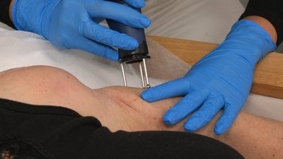 Допомагає відновити руку жительці Вугледара. Як в Івано-Франківську впроваджують проєкт "Неопалимі" Допомагає відновити руку жительці Вугледара. Як в Івано-Франківську впроваджують проєкт "Неопалимі"