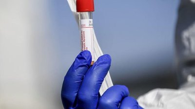 За добу у Сумській області коронавірус виявили у 367 людей, двоє - померли від ускладнень