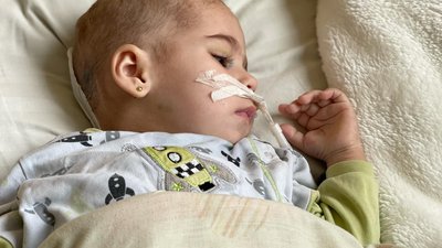 Лікарі видалили 3-см пухлину мозку однорічної дитини під час обстрілу, коли Львів був знеструмлений Лікарі видалили 3-см пухлину мозку однорічної дитини під час обстрілу, коли Львів був знеструмлений