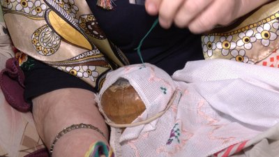 Вишиває однією лівою рукою: як хмельничанка із церебральним паралічем освоїла техніки вишивання