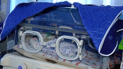 У Житомирі вдвічі збільшилася кількість передчасно народжених дітей У Житомирі вдвічі збільшилася кількість передчасно народжених дітей