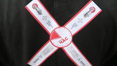 МОЗ хоче втричі збільшити фінансування лікування туберкульозу