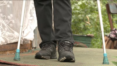 "Рідні думали, що двохсотий": поранений боєць із Черкащини потребує допомоги "Рідні думали, що двохсотий": поранений боєць із Черкащини потребує допомоги
