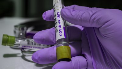 Сovid на Кіровоградщині: одна людина захворіла, четверо одужали