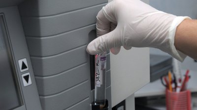 COVID-19 на Хмельниччині: нові інфіковані на Кам'янеччині та у Нетішині