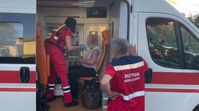 На Черкащині на пожежі чоловік отримав опіки обличчя