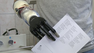 Центр протезування у Харкові Центр протезування у Харкові