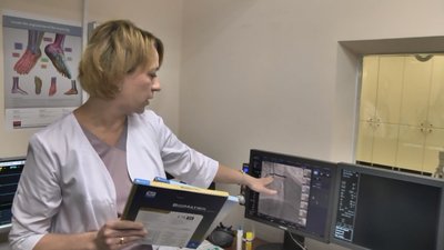 Ургентних хворих на Волині стентуватимуть за зниженою ціною.