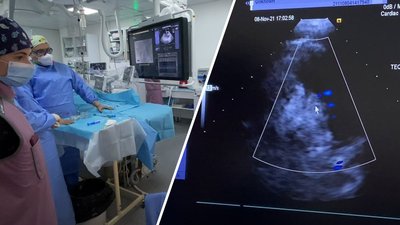 У львівській лікарні відкрили відділення дитячої кардіохірургії