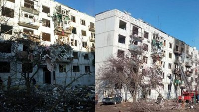 "Тебе любитимуть попри шрами": історія дівчинки, яка вижила під час обстрілу у Чугуєві "Тебе любитимуть попри шрами": історія дівчинки, яка вижила під час обстрілу у Чугуєві
