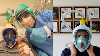 В Італії із масок для дайвінгу роблять апарати для вентиляції легенів