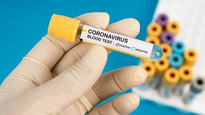 В Одеській області провели понад 4 тисячі тестів на коронавірус