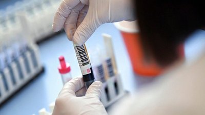 В Україні різко скоротилась кількість нових інфікувань COVID-19