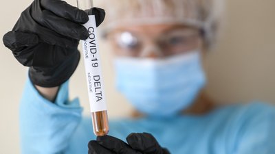 45 нових випадків захворювання на COVID-19 виявили на Херсонщині за добу