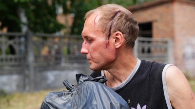поранений чоловік