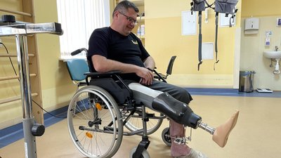У Львові пацієнту встановили протез за 4 години У Львові пацієнту встановили протез за 4 години