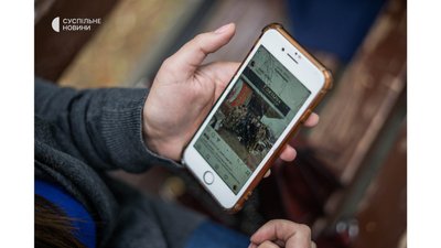 "Хочу стерти з тіла сліди війни". Через 4 місяці після поранення волонтерка наважилася на операцію по видаленню шрамів "Хочу стерти з тіла сліди війни". Через 4 місяці після поранення волонтерка наважилася на операцію по видаленню шрамів