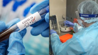 Ситуація щодо COVID-19 на Закарпатті станом на 9 годину 19 квітня (ФОТО)