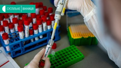 За добу на Вінниччині зафіксували 10 нових випадків COVID-19