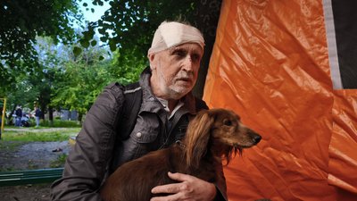 Чоловік, який постраждав від російської атаки на Лук'янівку