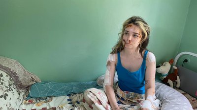 Частину перевели до інших лікарень: який стан травмованих через обстріл ТЦ Кременчука Частину перевели до інших лікарень: який стан травмованих через обстріл ТЦ Кременчука