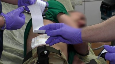 Будні лікарів військового госпіталю Запоріжжя Будні лікарів військового госпіталю Запоріжжя