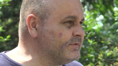 Напад на адвокатів у Франківську: потерпілі назвали ймовірних замовників побиття Напад на адвокатів у Франківську: потерпілі назвали ймовірних замовників побиття