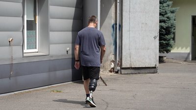 У Дніпрі виготовляють протези для бійців та цивільних і навчають ними користуватися У Дніпрі виготовляють протези для бійців та цивільних і навчають ними користуватися