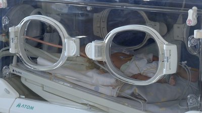 У Рівному з'явились нові інкубатори для глибоко недоношених діток. Гроші дали меценати