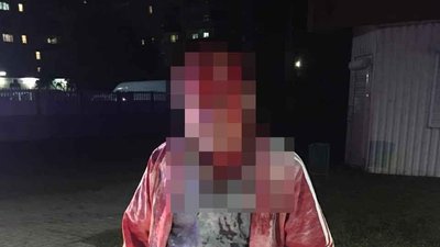 На Волині нападник бив потерпілого вогнегасником та вкрав гроші На Волині нападник бив потерпілого вогнегасником та вкрав гроші