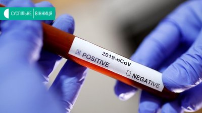 Обласний лабораторний центр отримає німецьку тест-систему для виявлення коронавірусу