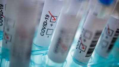 За добу у Сумській області виявили 57 людей з коронавірусом