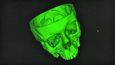 Кістки та органи: у Маріуполі створюють 3-D моделі, які допомагають медикам під час операції Кістки та органи: у Маріуполі створюють 3-D моделі, які допомагають медикам під час операції