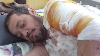 "Свою кішку не врятувала, рятую інших тварин": історія переселенки з Сєвєродонецька, яка живе на Волині "Свою кішку не врятувала, рятую інших тварин": історія переселенки з Сєвєродонецька, яка живе на Волині